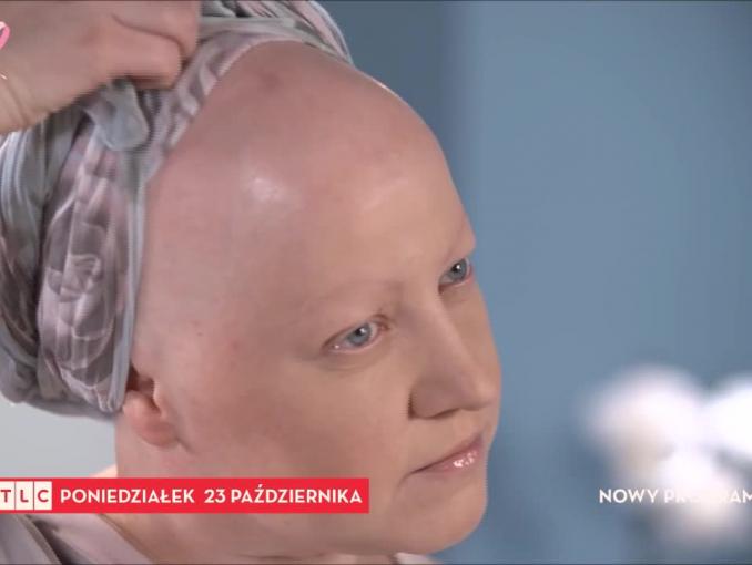 "Co mi dolega?" - nowy program TLC Polska